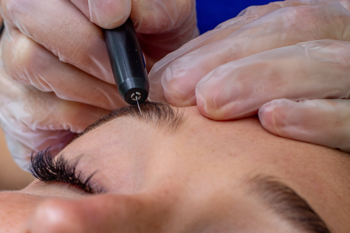 Why adding electrolysis makes business sense for Australian salons and clinics